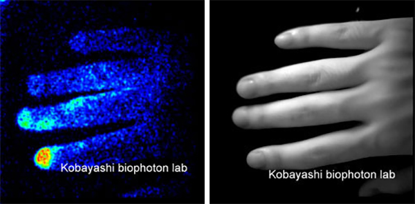 Two photos showing a B&W photo of the hand and tissue damage that is not visible to the naked eye