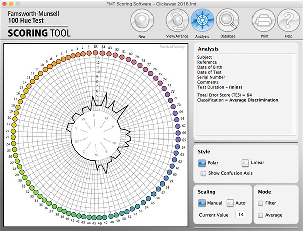 Results from the Farnsworth Munsell 100 Hue Test showing a score of normal or average