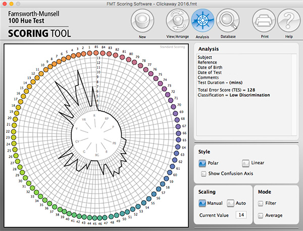 Results from the Farnsworth Munsell 100 Hue Test showing a score of low or weakness